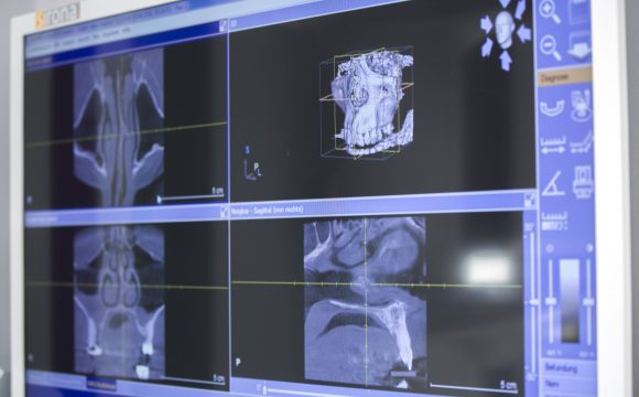 3D Röntgendiagnostik