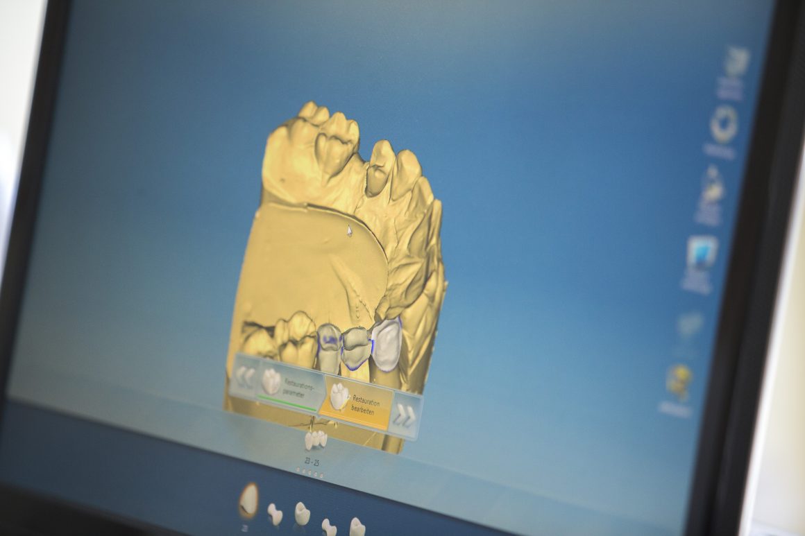 3D Implantologie